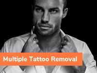 The Tattoo Removal Experts image 5